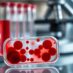 Choroby krwi – objawy, diagnostyka i leczenie schorzeń hematologicznych